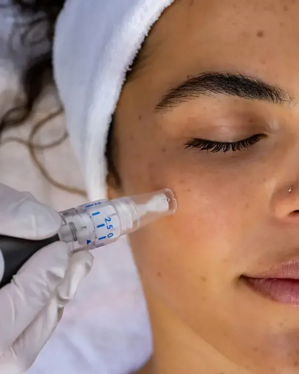 Microneedling Course training course