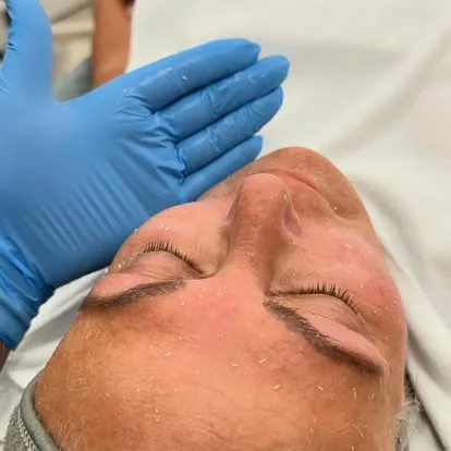 Advanced Skin Treatments